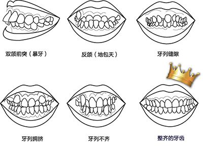 牙齿矫正