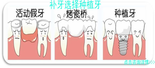 牙齿缺失修复方法选择种植牙