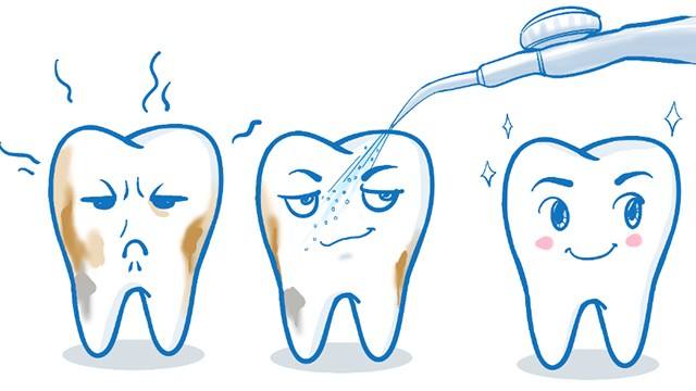 洗牙有危害是真的吗？