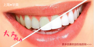美白牙齿都有那些方法