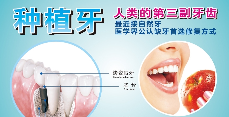 为什么种植牙那么贵?