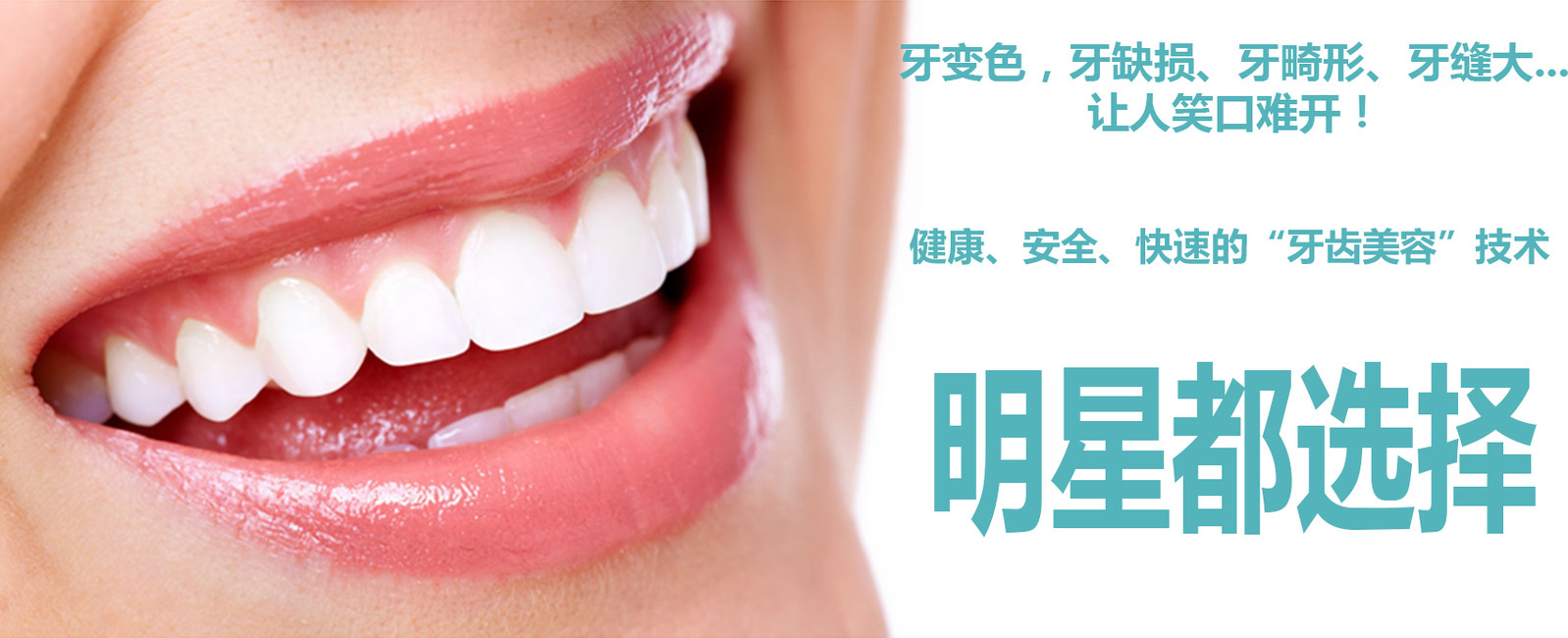 牙贴面是什么?