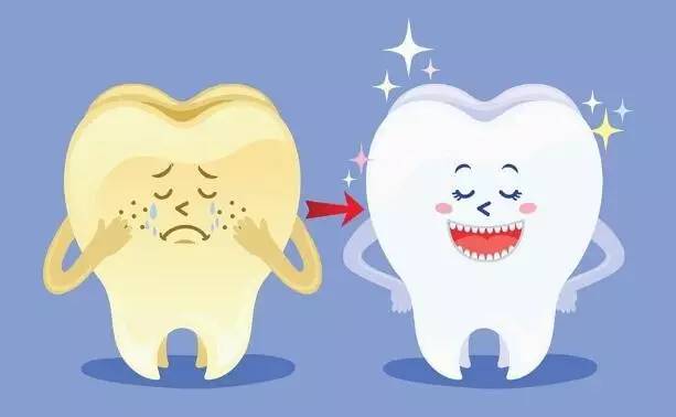  牙齿做激光美白多少钱?