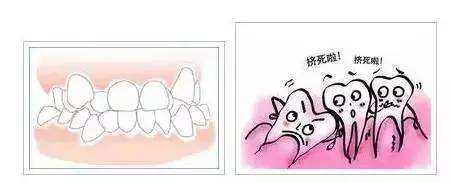 牙齿不齐都会有那些危害?