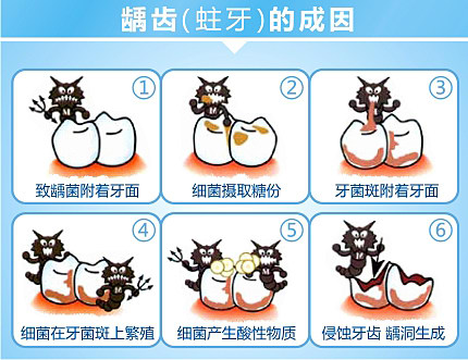 儿童远离牙齿矫正要从长牙开始预防