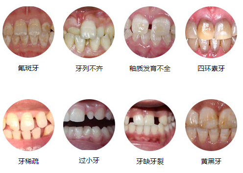 不正规的牙齿矫正带来的伤害都有那些