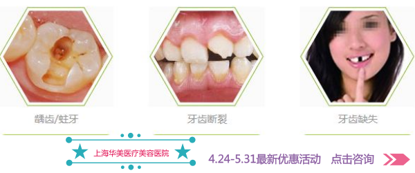 拔牙后注意事项有那些?记住这8个