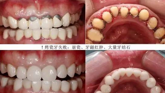 上海矫正牙齿哪家医院好