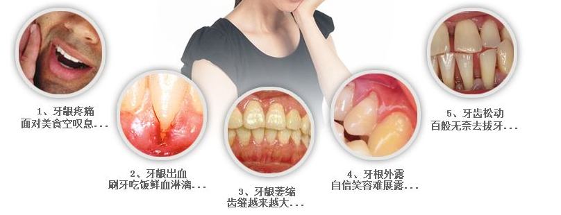 那些疾病了能引起牙龈出血